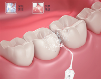 家庭口腔清潔新寵 為何這個(gè)品牌正悄然超越潔碧，成為水牙線首選